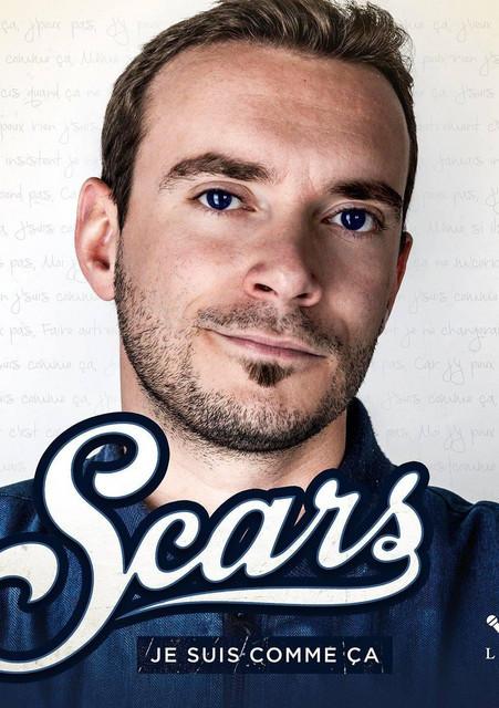 Scars
