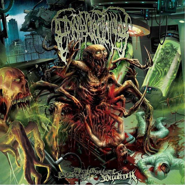 Epicardiectomy