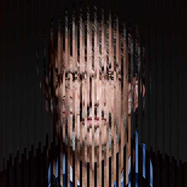 Triggerfinger